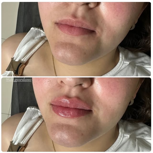 Diseño de labios